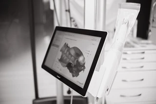 3d сканер 3Shape для имплантации