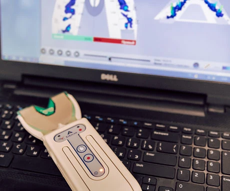 T-scan (Т-скан) для диагностики окклюзии