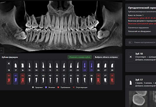 Искусственный интеллект Diagnocat